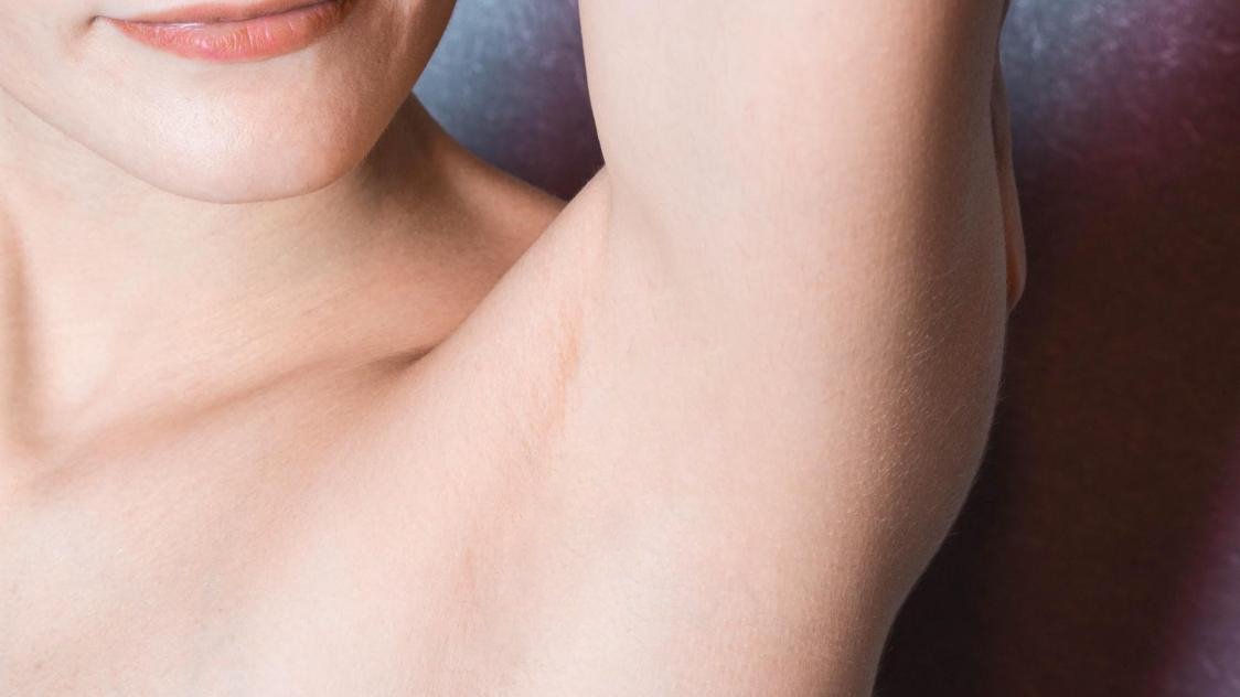 epilation-laser-resultat-apres-dermelux