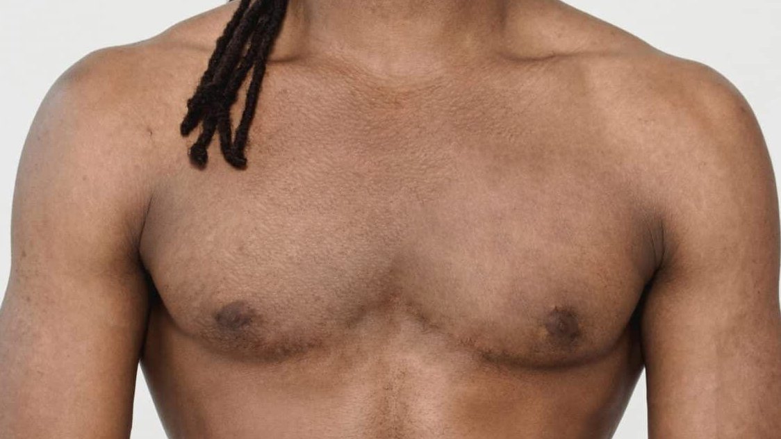 epilation-torse-apres-dermelux