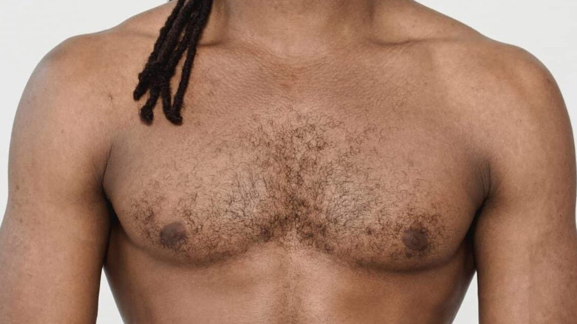 epilation-torse-avant-dermelux